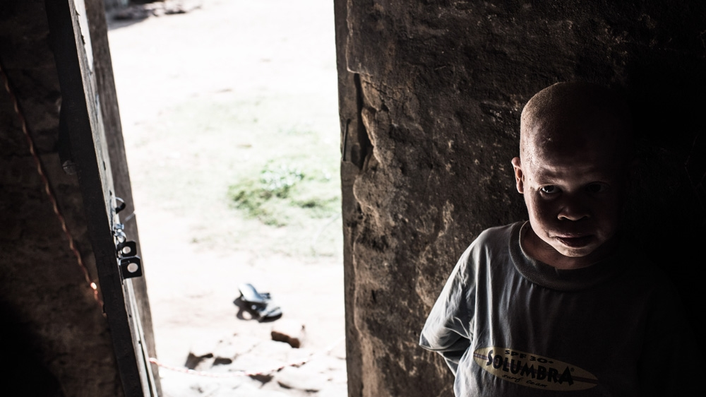 Semuju stays inside the house in the middle of the day, when the sun is blazing outside. Without sun cream or a hat, his skin begins to suffer within minutes [Fredrik Lerneryd/Al Jazeera]
