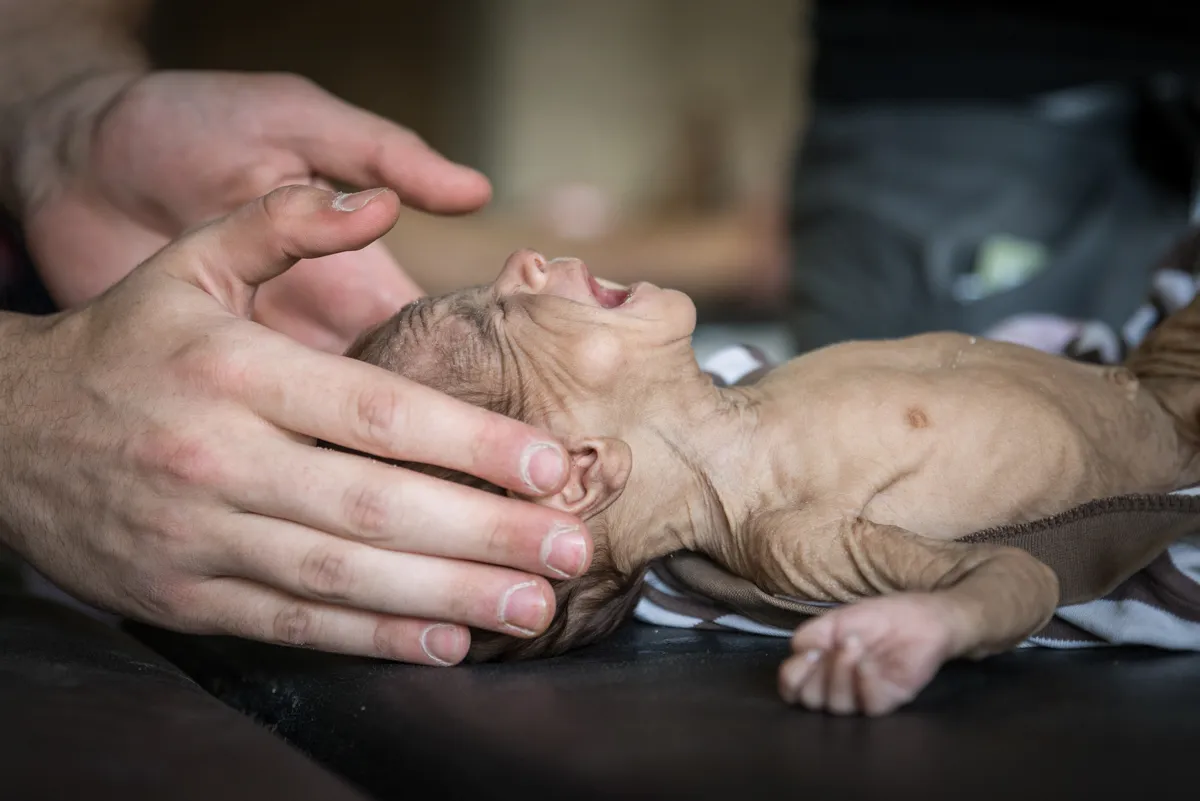 Saving lives on the frontline in the fight against ISIL/Please Do Not Use
